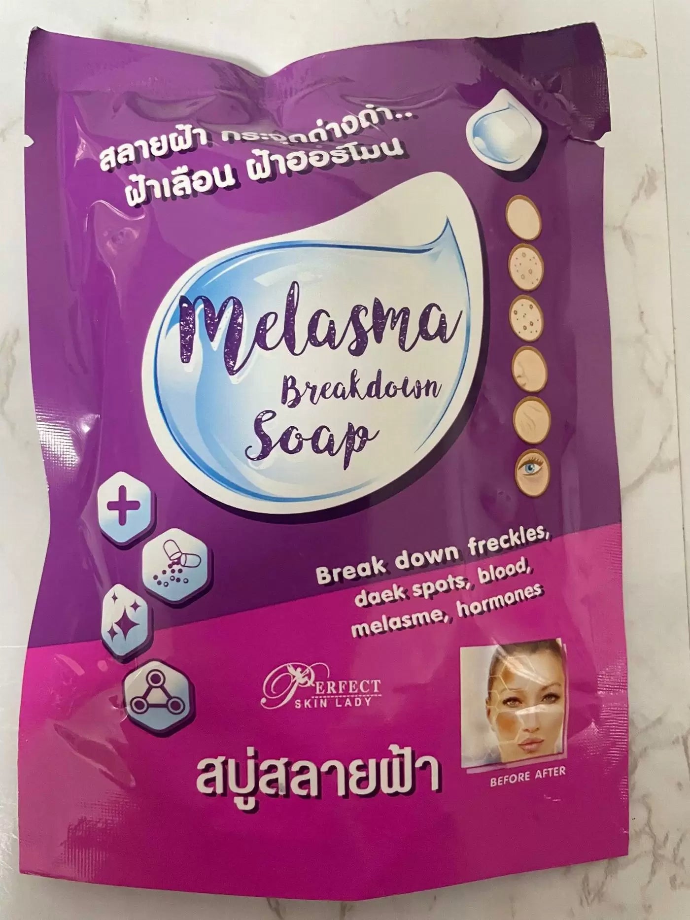 Perfect Skin Lady Melasma Breakdown Soap 80g