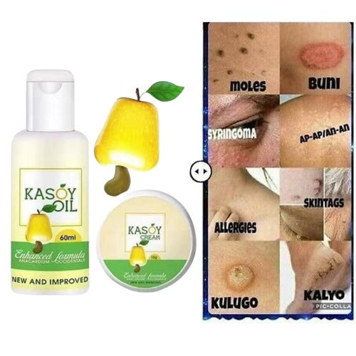 Kasoy Oil 60mL