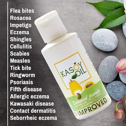 Kasoy Oil 60mL