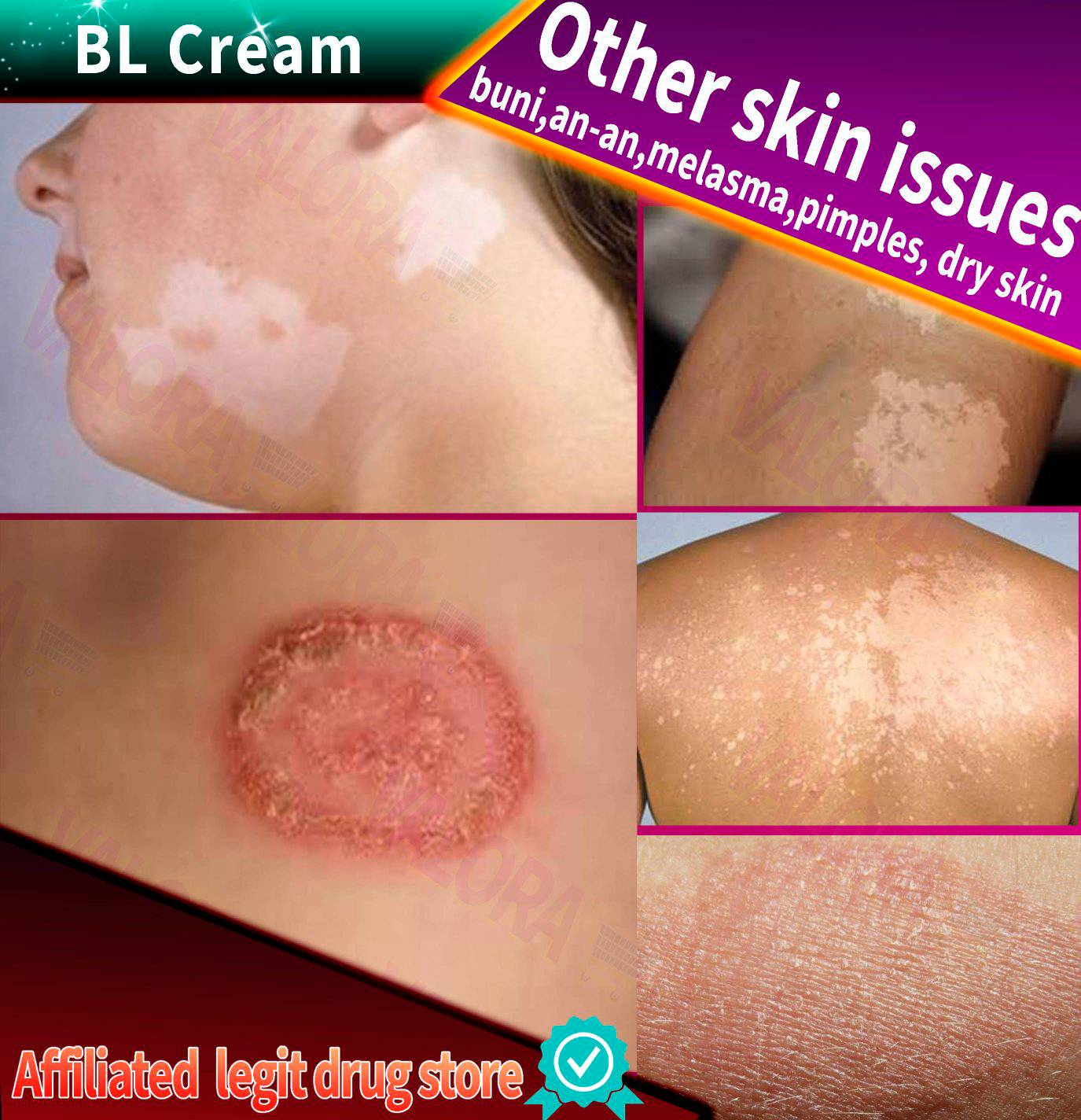 BL Cream 7g