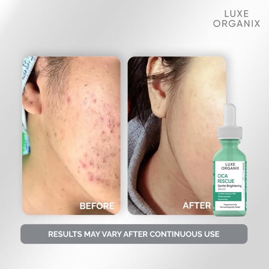 Luxe Organix Cica Rescue Gentle Brightening Serum 30mL